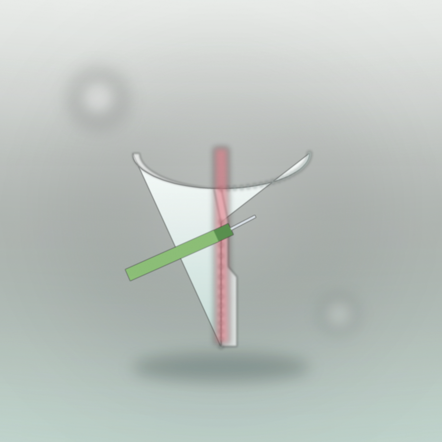Endodoncia